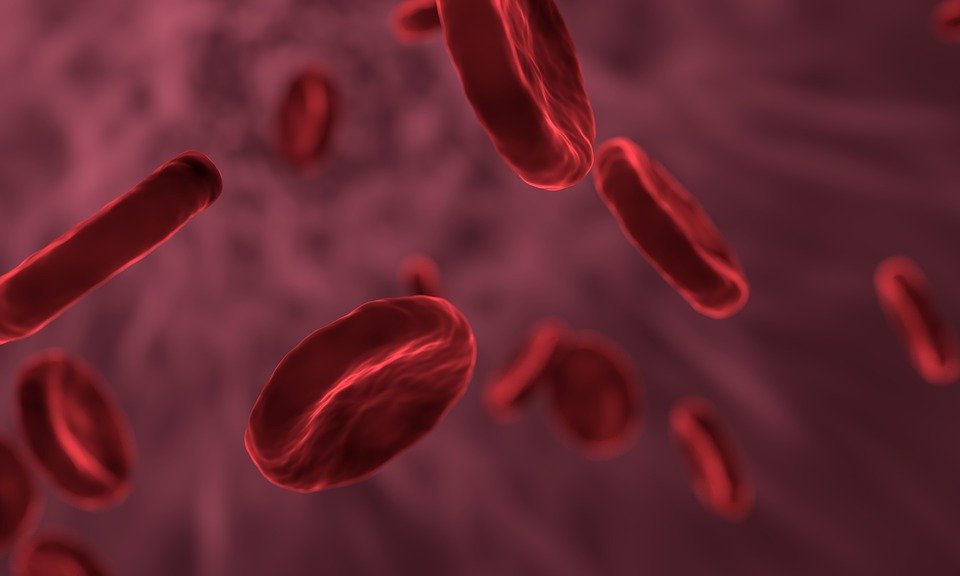 Niedokrwistość (anemia) z niedoboru żelaza – przyczyny, objawy, leczenie