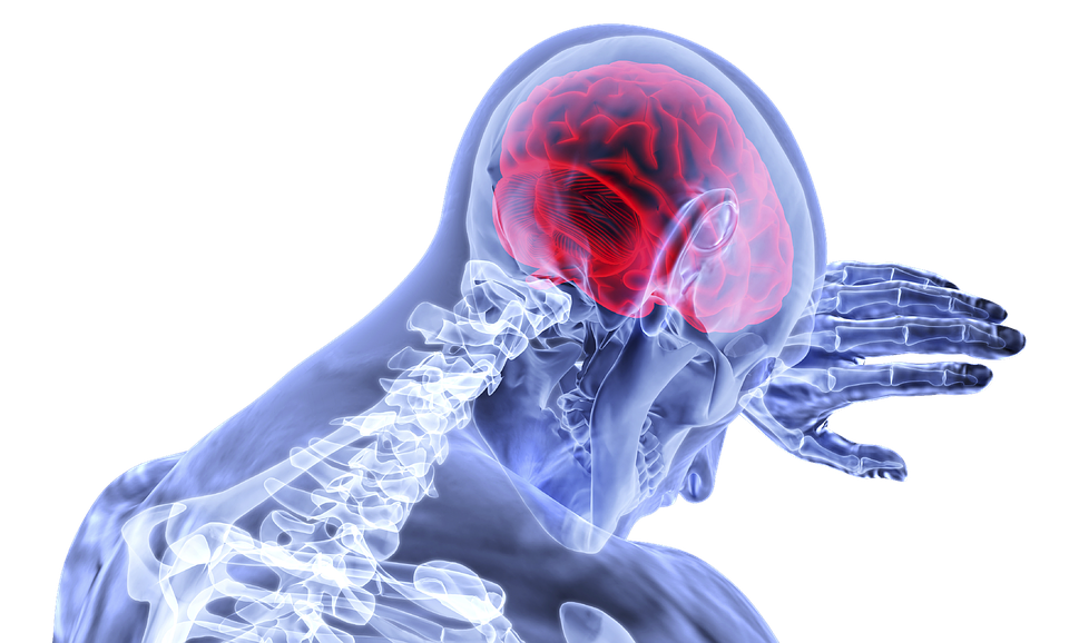 Udar mózgu – przyczyny, objawy, leczenie, powikłania, rehabilitacja